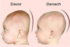 CozyNest- Verstellbares Babynest für gesunden Schlaf und Linderung von Reflux und Koliken