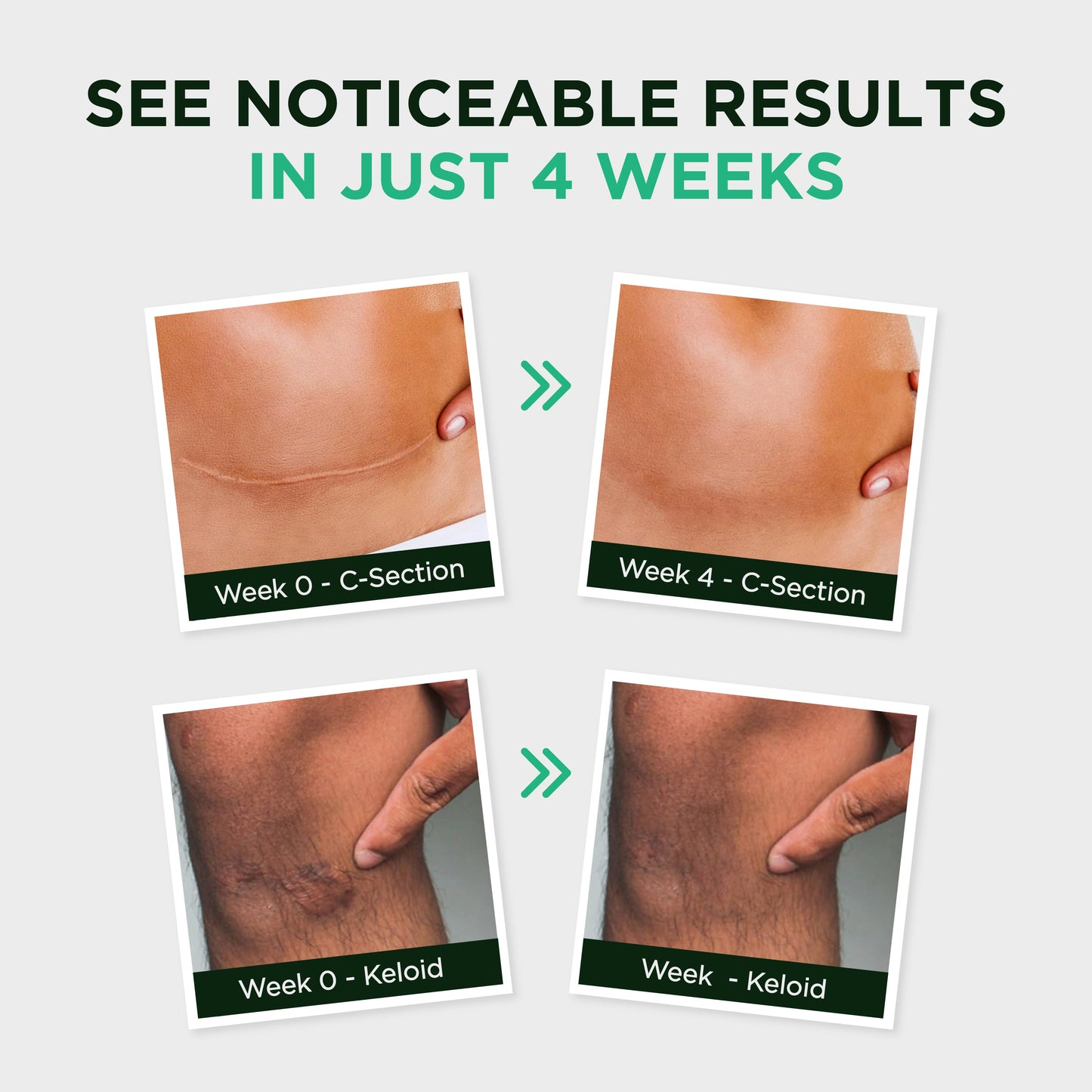 MEDICAL-GRADE SILICONE SCAR RECOVERY SHEETS